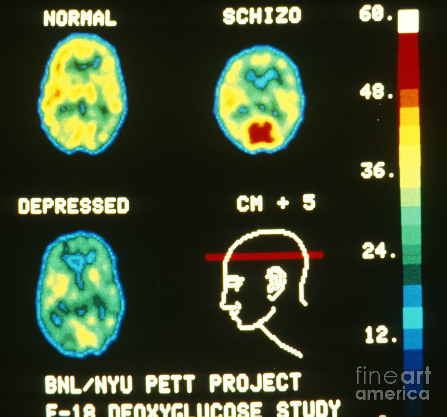Pet Photograph - Brain Scans by Science Source