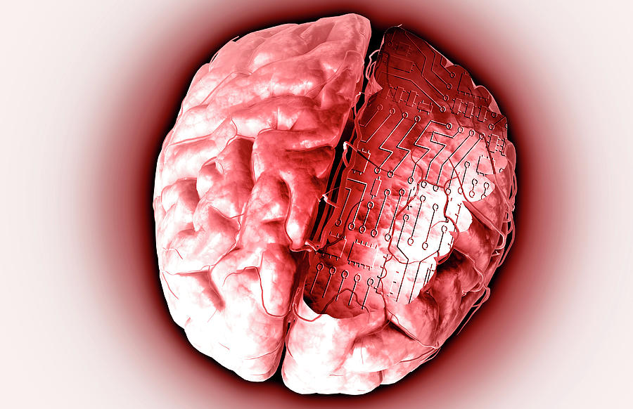 Brain With Circuit Board Digital Art by MedicalRF.com