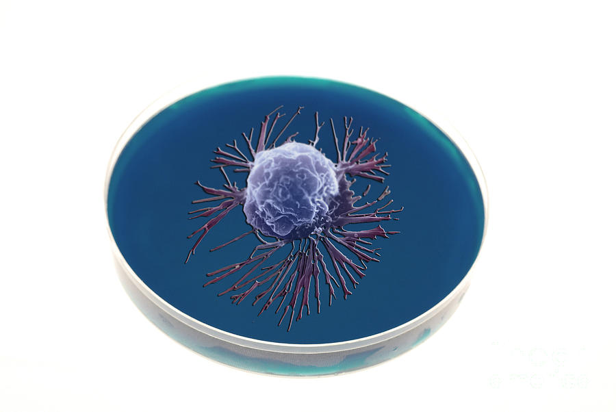Breast Cancer Cell In A Petri Dish Photograph by Photo Researchers