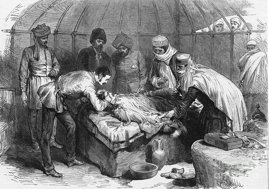 Burn Surgery, 1885 Photograph by Science Source