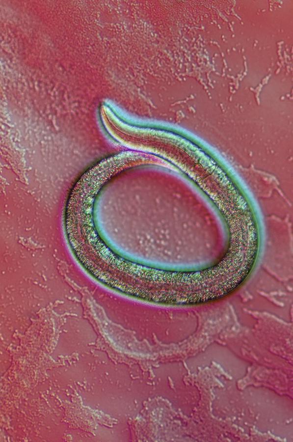 C. Elegans Mutant Worm, Light Micrograph Photograph by Sinclair ...