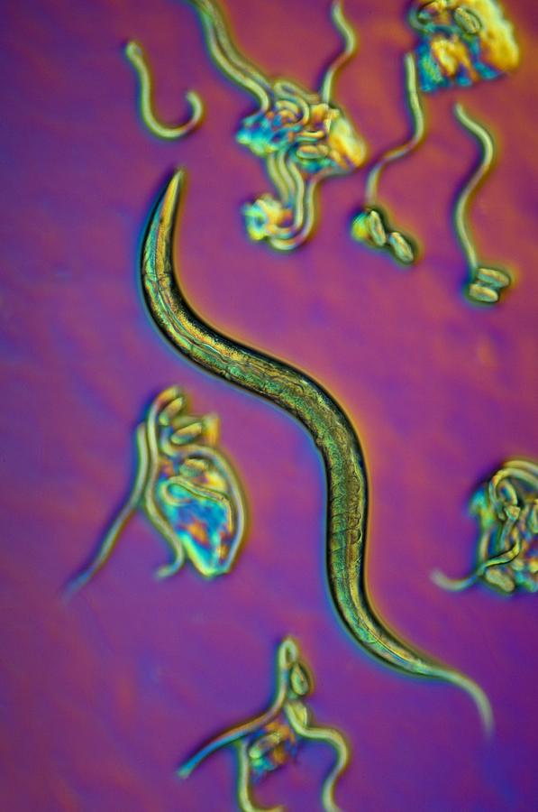 C. Elegans Worms, Light Micrograph Photograph by Sinclair Stammers ...