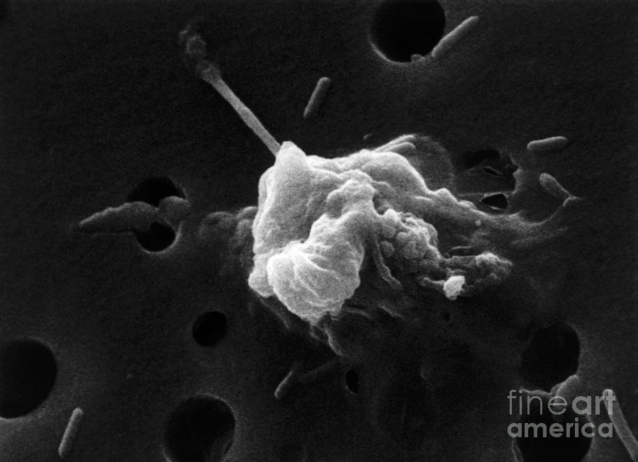 Cancer Cell Death 6 Of 6 Photograph by Science Source