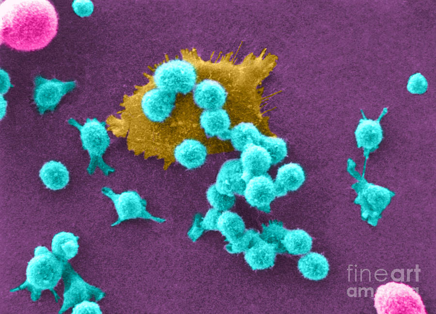 Cancer Cell Death, Sem 2 Of 6 Photograph by Science Source