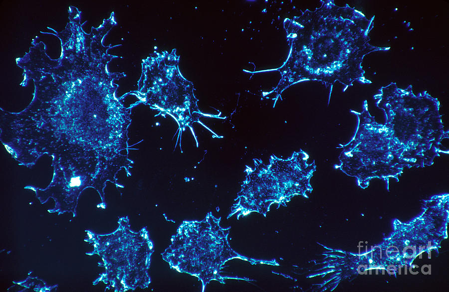 Cancer Cells Photograph by Science Source