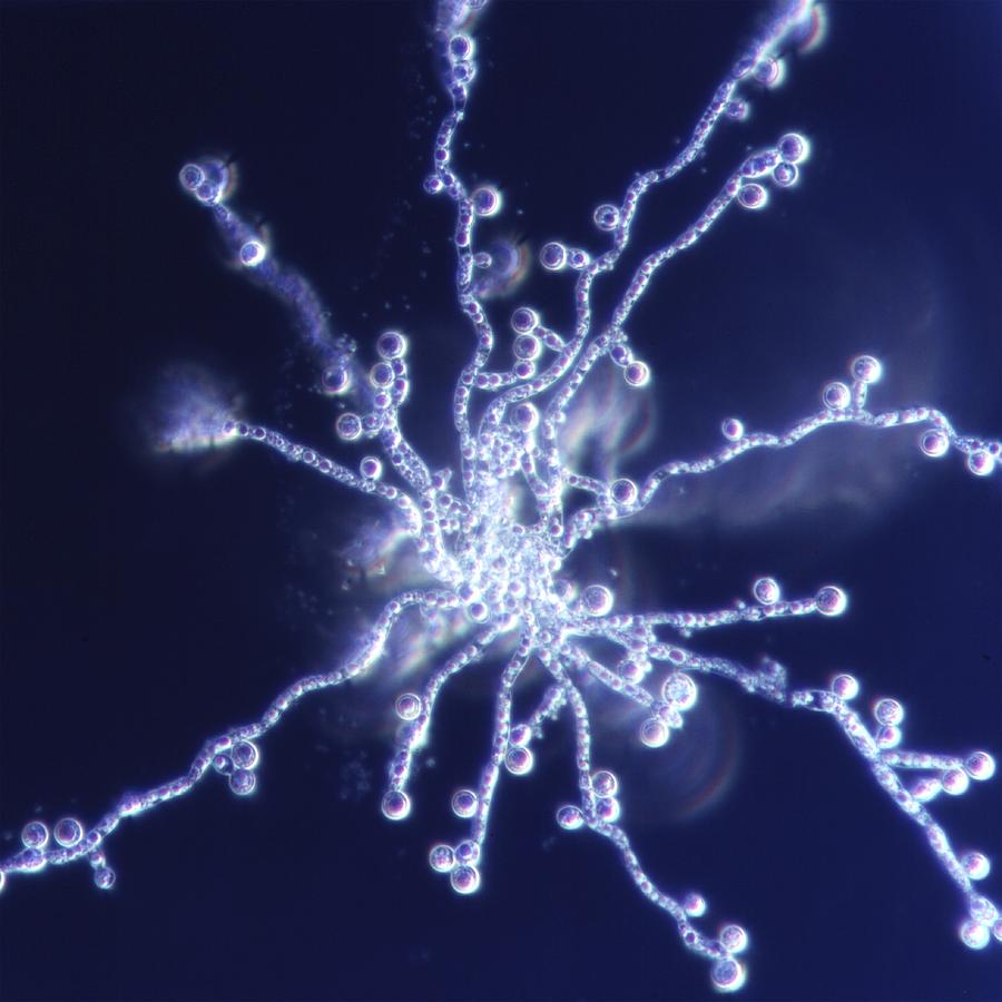 Candida Albicans Fungus, Light Micrograph Photograph by Pasieka