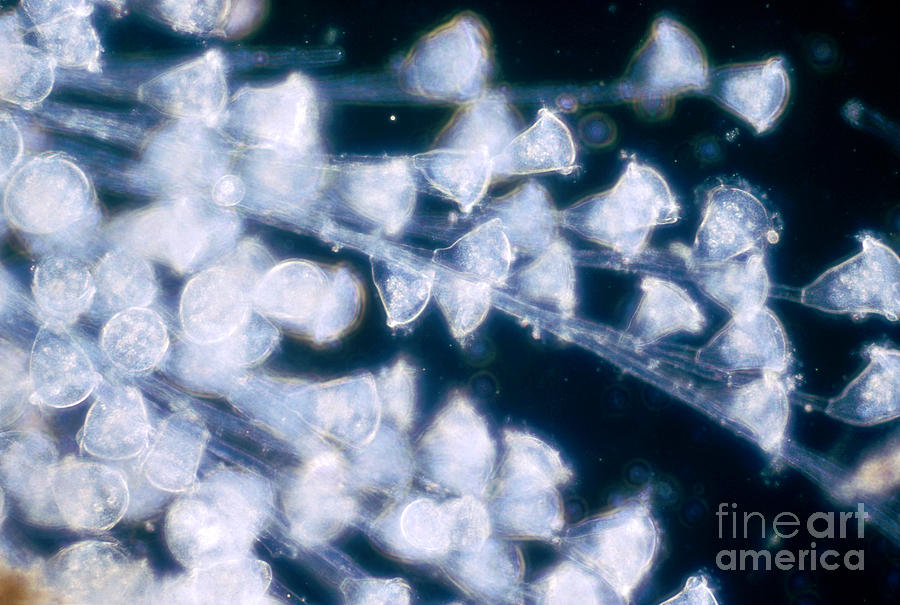 Light Microscopy Photograph - Carchesium Protozoan by M. I. Walker