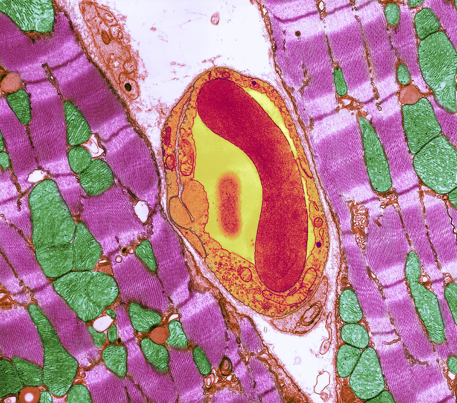Mitochondrion Photograph - Cardiac Muscle And Capillary, Tem by Thomas Deerinck, Ncmir
