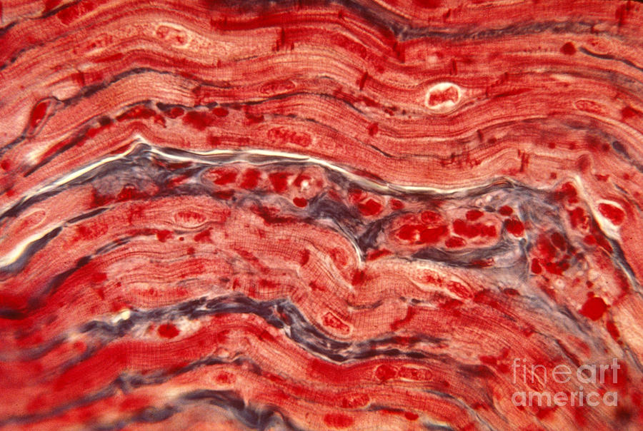 Cardiac Muscle Photograph by Eric V. Grave