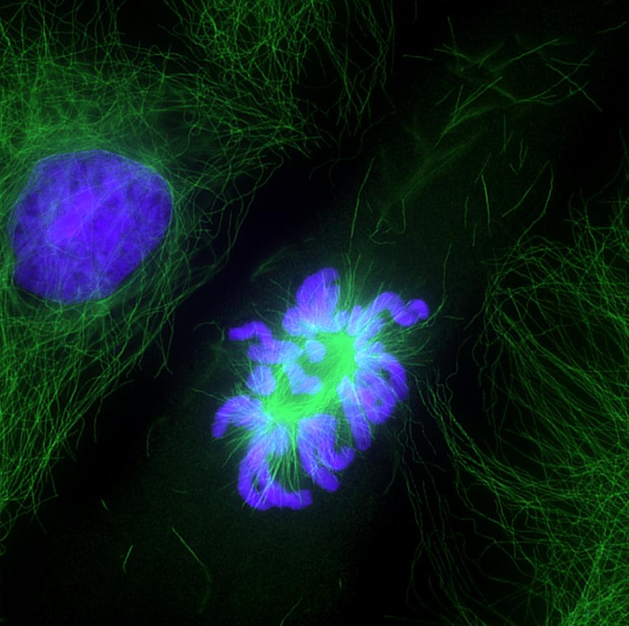 Prometaphase Photograph - Cell Division, Fluorescent Micrograph by Dr Torsten Wittmann