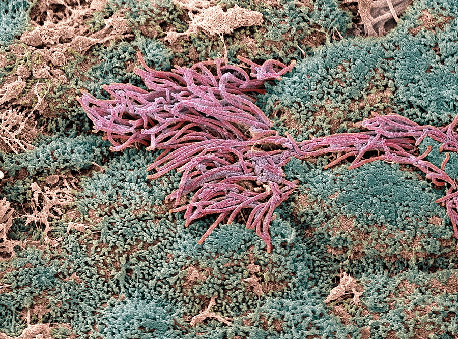 Cervical Lining, Sem Photograph by Steve Gschmeissner