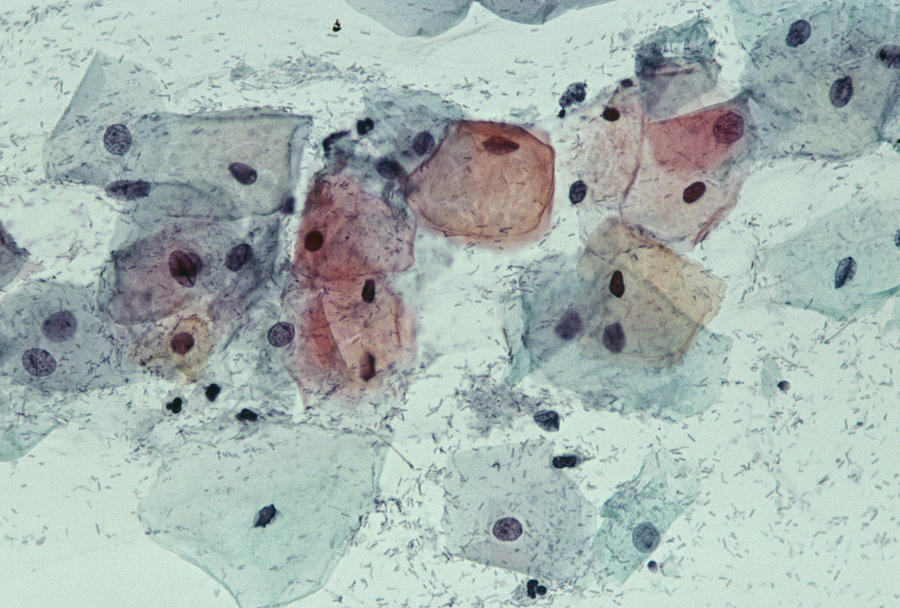 Lactobacillus Photograph - Cervical Smear Containing Bacteria by Dr. E. Walker