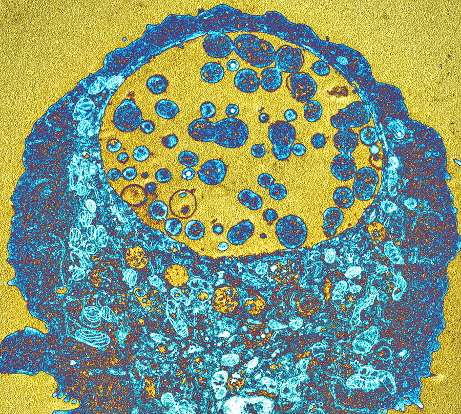 Pathogen Photograph - Chlamydia Bacteria, Tem by 