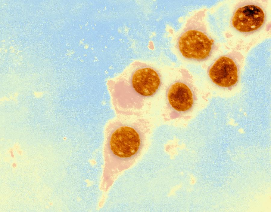Chlamydia Trachomatis Photograph - Chlamydia Trachomatis Bacteria, Tem by Ami Images