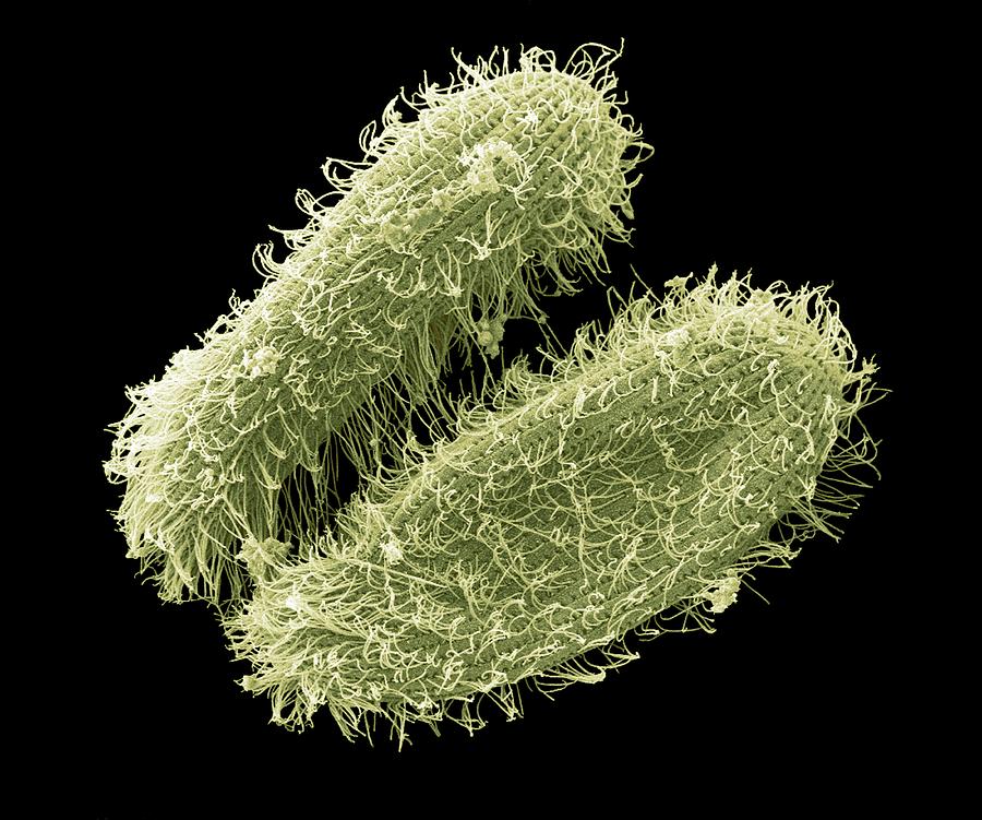 Nature Photograph - Ciliate Protozoa, Sem by Steve Gschmeissner