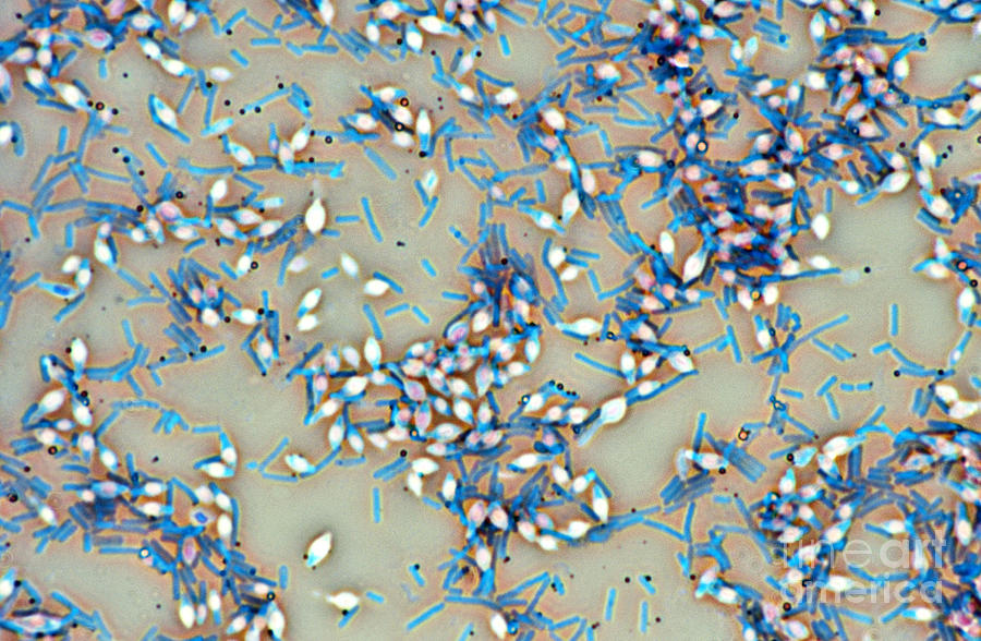 Clostridium Botulinum Photograph by M. I. Walker