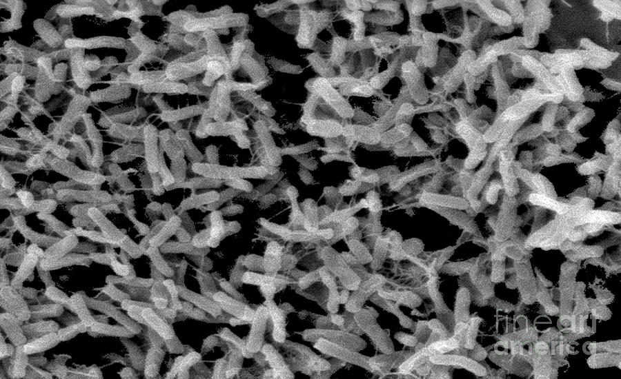 Clostridium Difficile Bacteria, Sem Photograph by Science Source