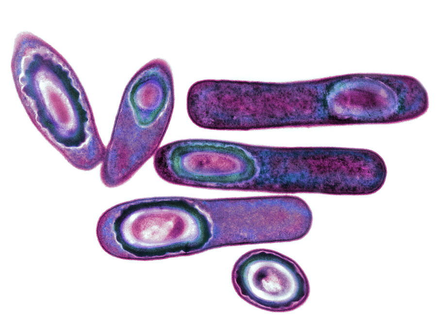 Clostridium Difficile Photograph - Clostridium Difficile Bacteria, Tem by Biomedical Imaging Unit, Southampton General Hospital