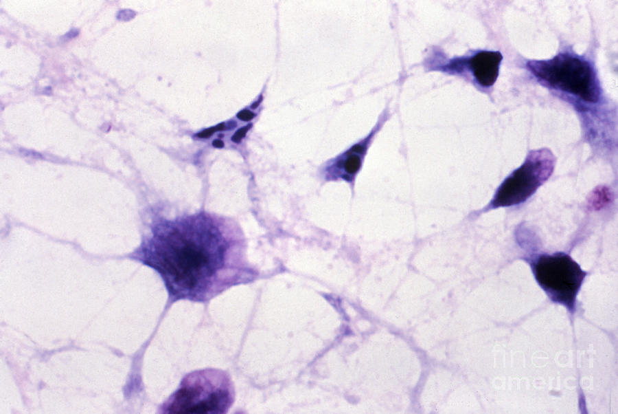 Clostridium Difficile, Lm Photograph by Science Source