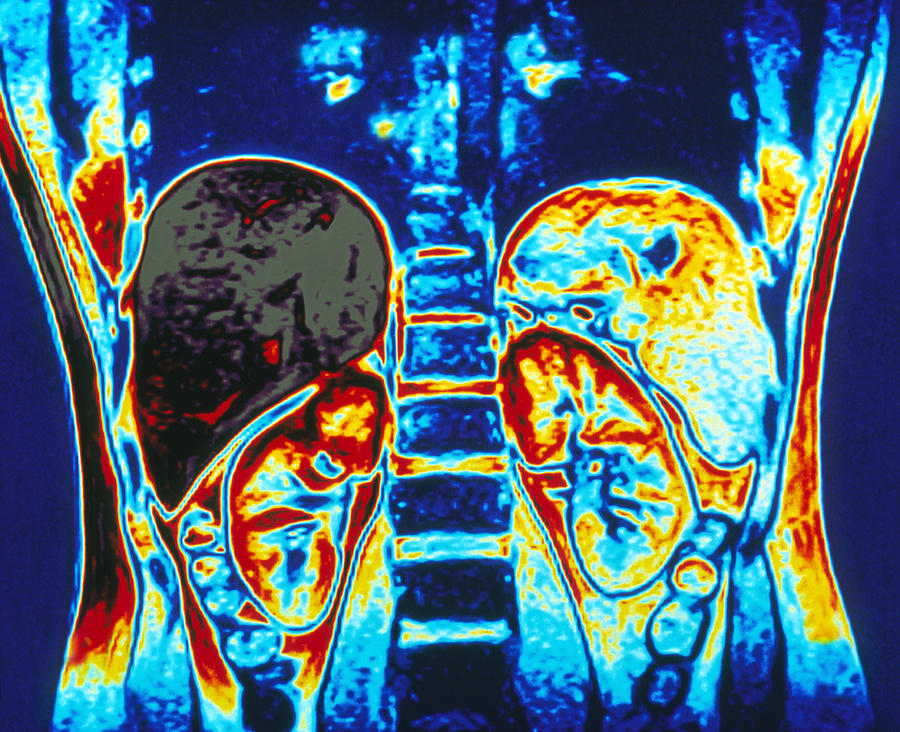 Coloured MRI whole body scan of a man - Stock Image - P835/0045