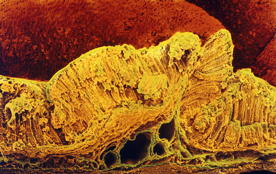 Stomach Photograph - Colour Sem Of Cross-section Through Stomach Wall by Prof Cinti & V. Gremetspl