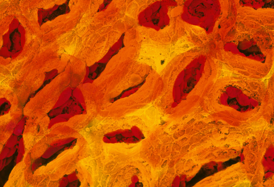 Fundus Photograph - Colour Sem Of The Stomach Mucosa & Gastric Pits by Prof Cinti & V. Gremetspl