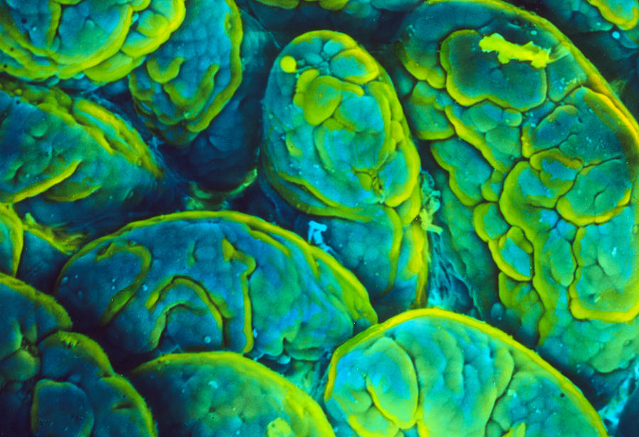 Villus Photograph - Colour Sem Of Villi In The Small Intestine by Prof Cinti & V. Gremetspl