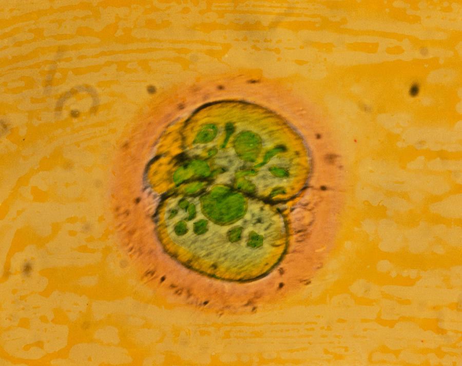 Blastomere Photograph - Coloured Lm Of A Human Embryo At Two-cell Stage by Professor P.m. Motta Et Al