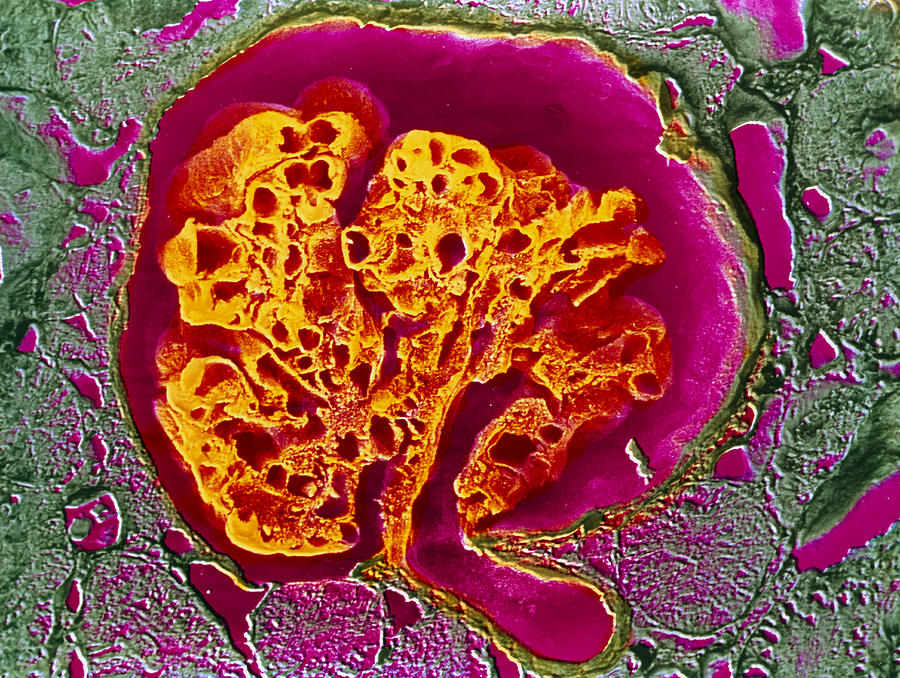 Coloured Sem Of A Renal Glomerulus Photograph by Cnri Photo Library ...