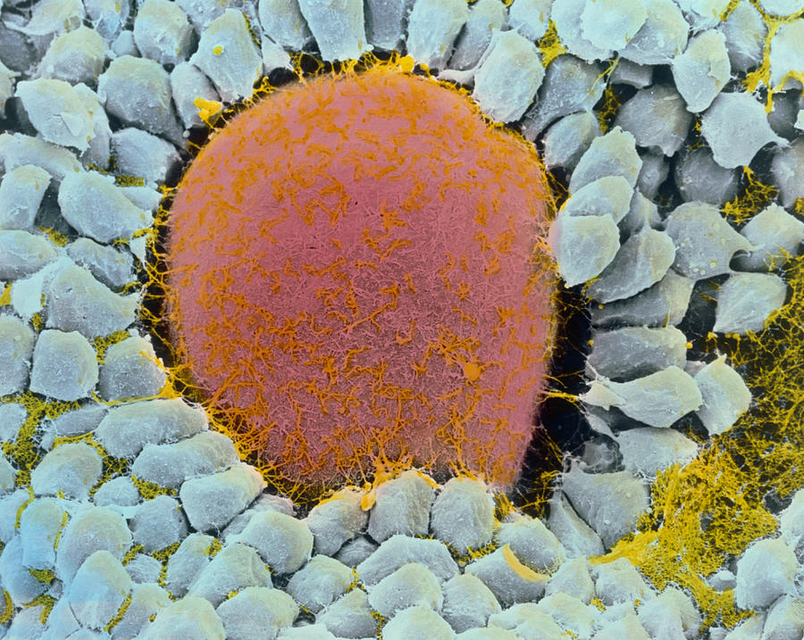 coloured-sem-of-egg-cell-in-secondary-follicle-photograph-by-professor