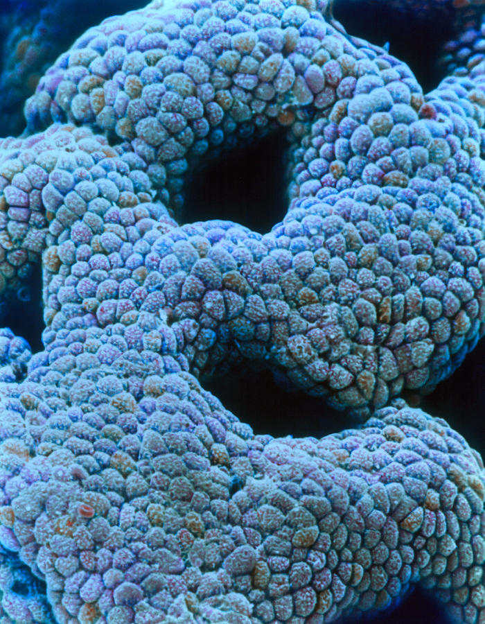 Images Photograph - Coloured Sem Of Gastric Pits In The Stomach Mucosa by Steve Gschmeissner