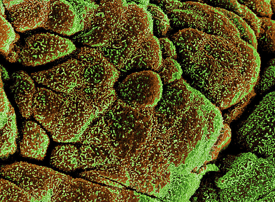 Bladder Photograph - Coloured Sem Of Healthy Bladder Epithelium by Steve Gschmeissner