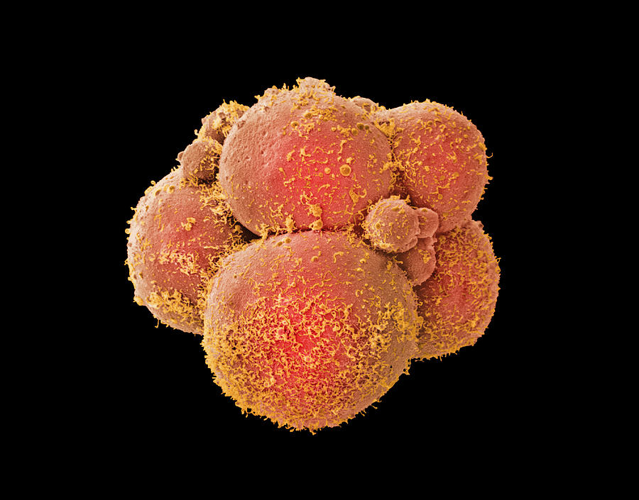 Coloured Sem Of Human Embryo At 8-cell Stage Photograph by Dr Yorgos ...