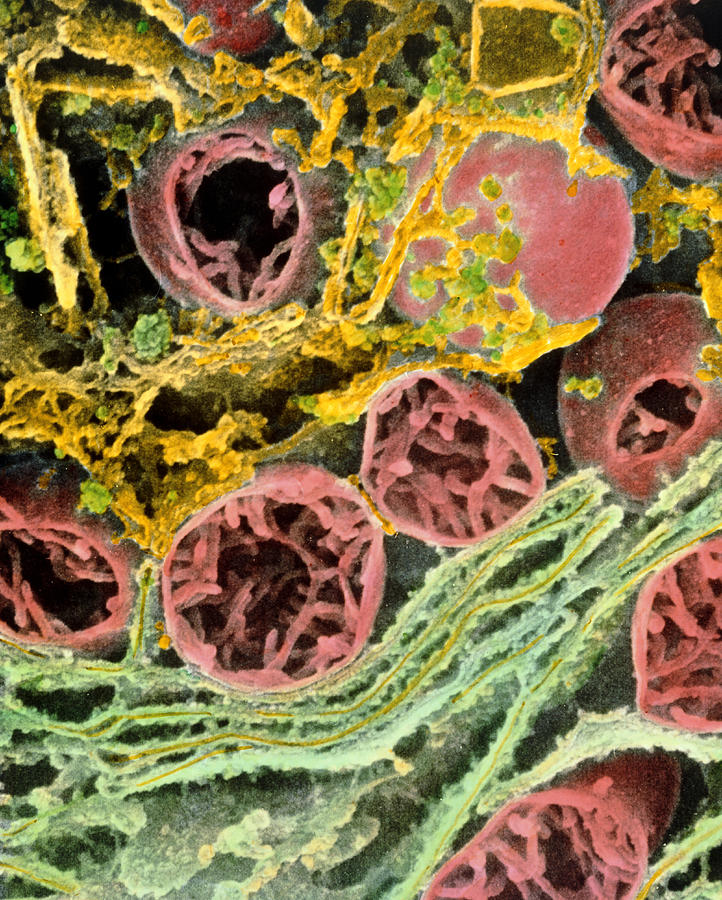 Coloured Sem Of Mitochondria & Er In A Liver Cell Photograph by ...