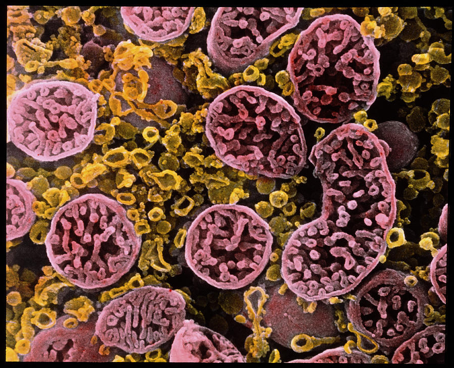 Coloured Sem Of Mitochondria In Ovarian Cells Photograph by Professors ...