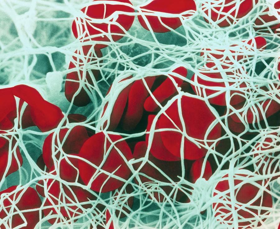 Coloured Sem Of Red Blood Cells Forming A Clot Photograph by Cnri - Pixels