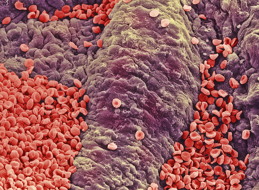 Images Photograph - Coloured Sem Of Red Blood Cells On Vessel Wall by Steve Gschmeissner