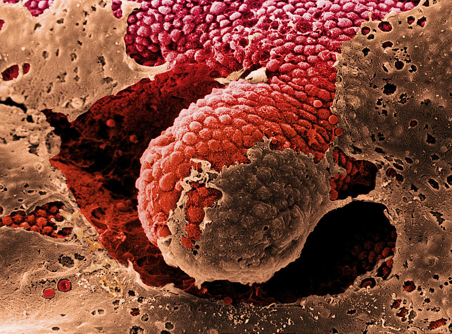 Images Photograph - Coloured Sem Of The Mucosa Of The Large Intestine by Steve Gschmeissner
