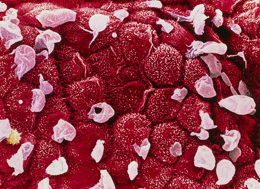Images Photograph - Coloured Sem Of The Mucosa Of The Rectum by Steve Gschmeissner