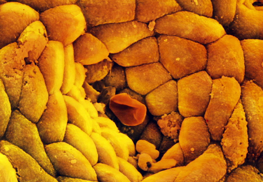 Fundus Photograph - Coloured Sem Of The Stomach Mucosa & Gastric Pit by Prof Cinti & V. Gremetspl