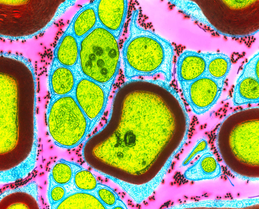 Coloured Tem Of A Section Through Nerve Fibres Photograph by Steve ...