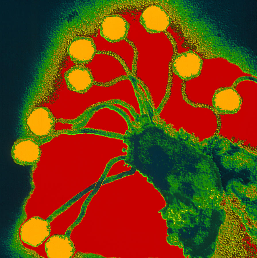 Coloured Tem Of Bacteriophages Attacking Bacteria Photograph By Dr Linda Stannard Uct Fine