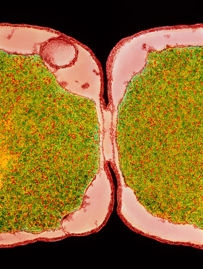 Coloured Tem Of E Coli Bacteria Dividing Photograph By Dr Kari