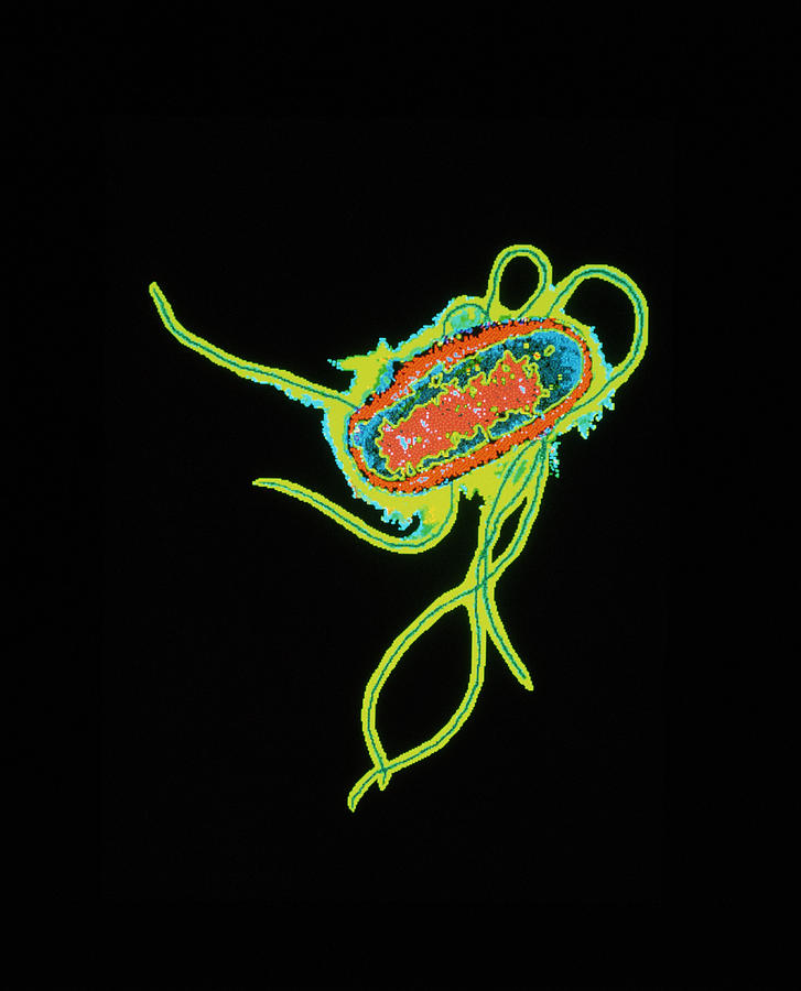 Coloured Tem Of Escherichia Coli Bacteria Photograph By Dr Linda Stannard Uct