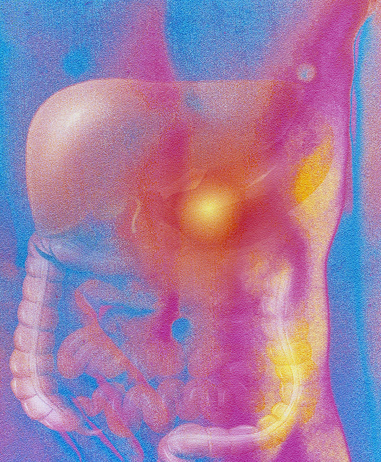 Gastric Ulcer Photograph - Computer Art Of Male Torso Depicting Stomach Pain by David Gifford