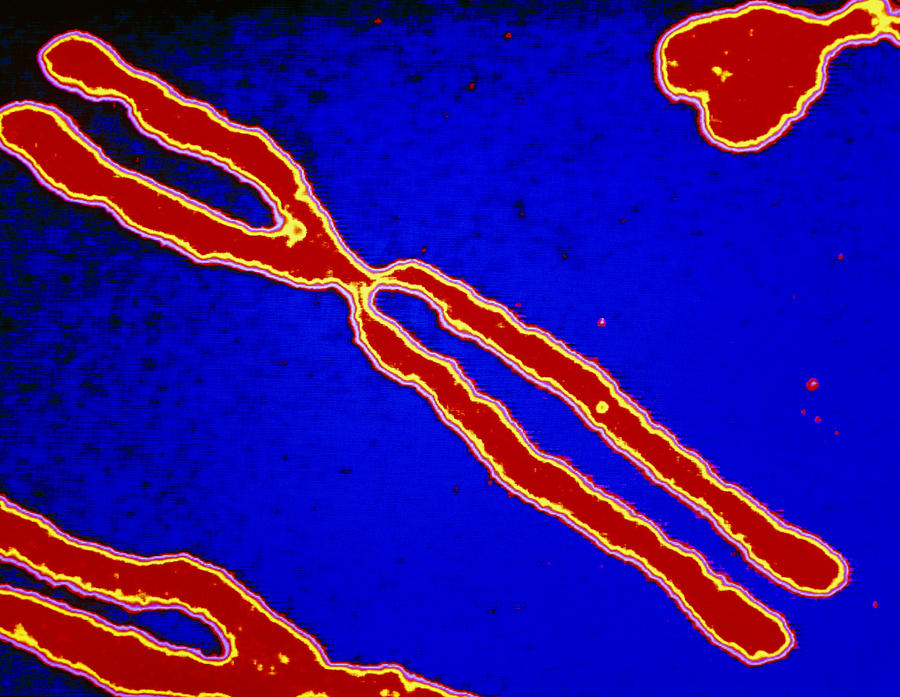 Computer Enhanced Lm Of Human Chromosomes Photograph By Pasieka Fine Art America 9299