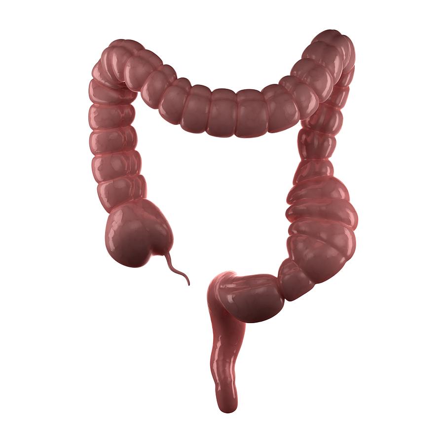 Constipated Colon Artwork Photograph By Sciepro Fine Art America 1252