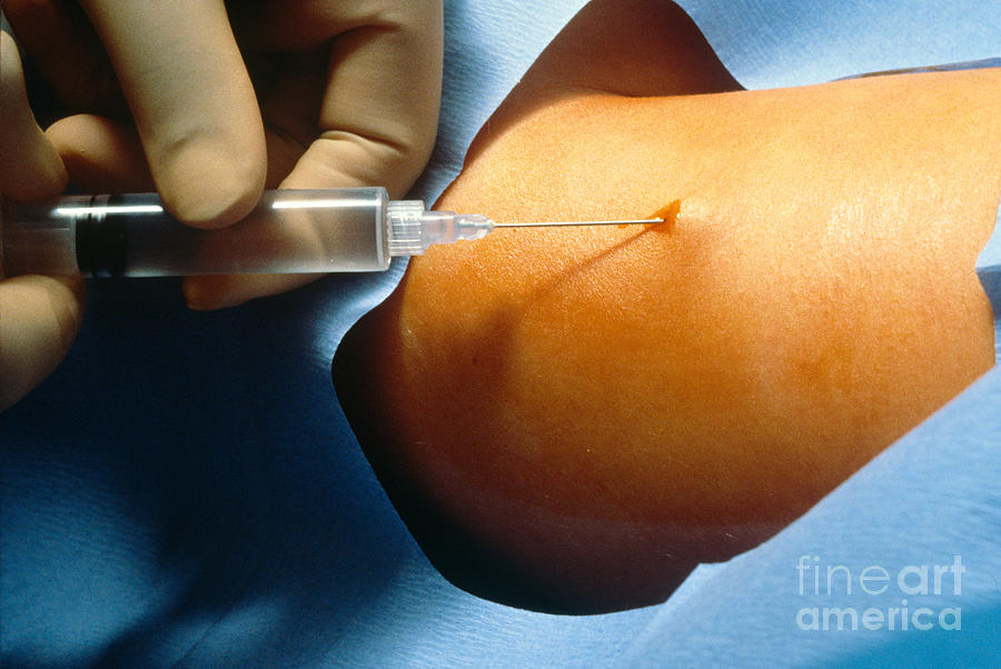Contraceptive Implant 1 Of 6 Photograph by Science Source