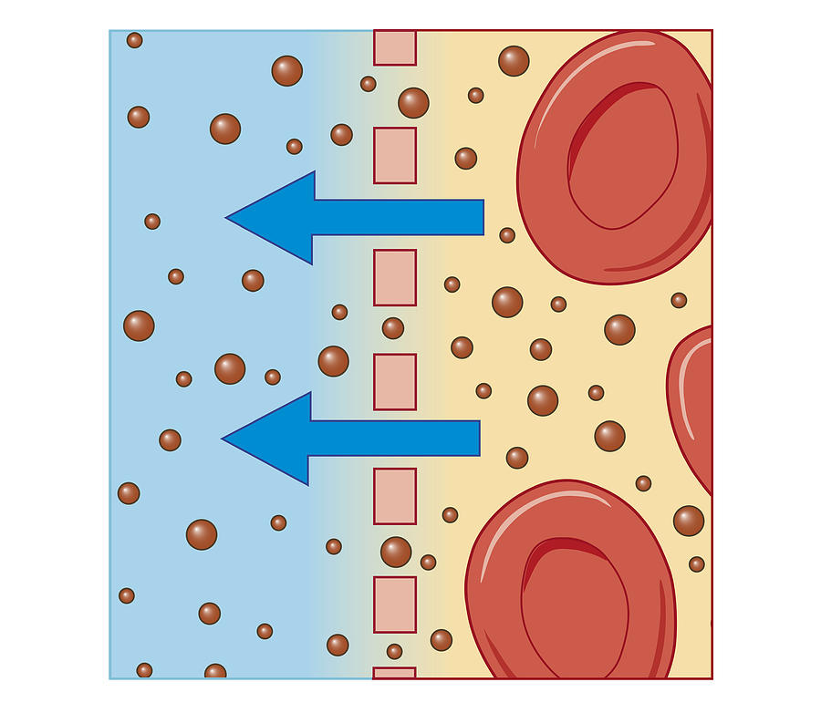 Cross Section Biomedical Illustration Of Kidney Dialysis Showing Waste Products And Excess Water Passing Through The Dialysate Membrane Digital Art by Dorling Kindersley