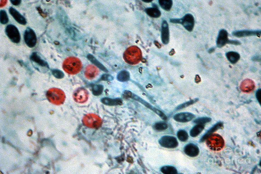 Cryptosporidium Oocysts Lm Photograph by Science Source